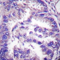 Anti-Caspase 7 p20 Antibody