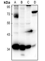 CD363 Rabbit Polyclonal Antibody