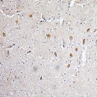 Anti-FGF1 Antibody