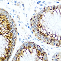 Anti-CCL2 Antibody