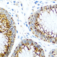 MCP1 antibody