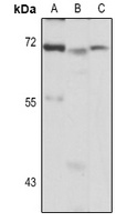 Ferroportin-1 Rabbit Polyclonal Antibody