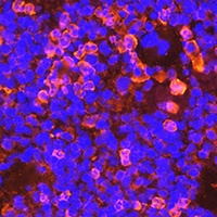 CD19 Rabbit Polyclonal Antibody