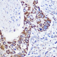 Anti-MTMR9 Antibody