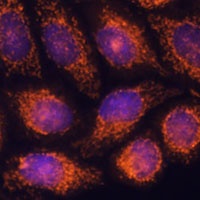 Anti-MTMR9 Antibody