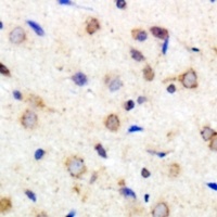 Anti-Laminin gamma 1 Antibody