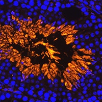 Anti-AKAP4 Antibody