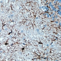 Anti-GFAP Antibody