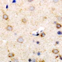 Anti-IL-22 Antibody