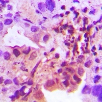Anti-IL-25 Antibody