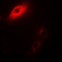 Anti-IL-25 Antibody