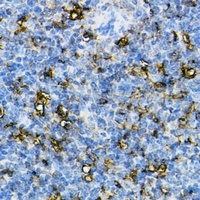 Anti-NLRP3 Antibody