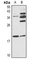 JDP2 Antibody