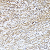 Septin 5 antibody