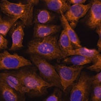 Septin 5 antibody