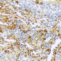 Anti-ACF Antibody