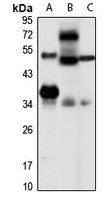 LYS5 Rabbit Polyclonal Antibody