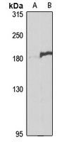 MRP5 Rabbit Polyclonal Antibody