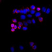 ABCG8 antibody