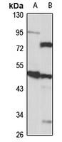 Abi-2 Rabbit Polyclonal Antibody