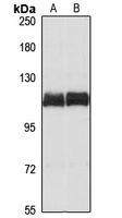 TARSH Rabbit Polyclonal Antibody