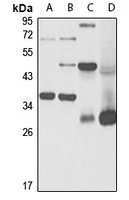 ABT1 Rabbit Polyclonal Antibody