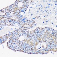 Anti-ACAA2 Antibody