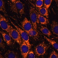 Anti-ACAA2 Antibody