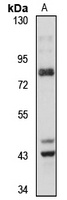 ACAD11 Rabbit Polyclonal Antibody