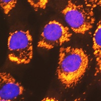 Anti-ACSL1 Antibody
