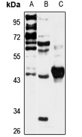 ACTL7B Rabbit Polyclonal Antibody