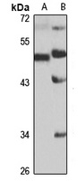 ACVR1 Rabbit Polyclonal Antibody
