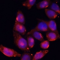 Anti-ACVR2B Antibody
