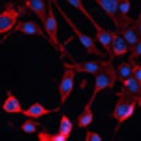 Anti-ADAM11 Antibody