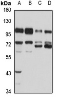 ADAM2 Rabbit Polyclonal Antibody