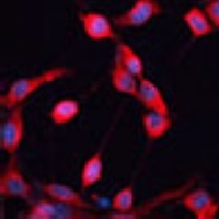 Anti-ADAMTS13 Antibody
