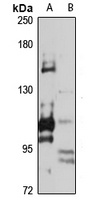 Adenylate Cyclase 3 Rabbit Polyclonal Antibody