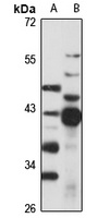 ADH1 Rabbit Polyclonal Antibody