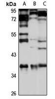 ARH1 Rabbit Polyclonal Antibody