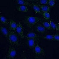 Anti-AEBP1 Antibody