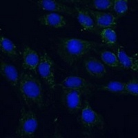 AEBP1 antibody