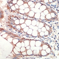 Anti-AFG3L2 Antibody
