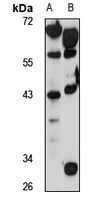 AJAP1 Rabbit Polyclonal Antibody
