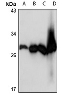 AK3 Antibody