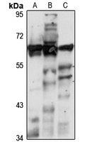 Adenylate Kinase 5 Rabbit Polyclonal Antibody