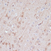 Adenylate Kinase 5 Rabbit Polyclonal Antibody