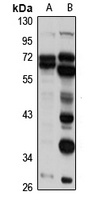 AKR1D1 Rabbit Polyclonal Antibody