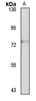 ALG9 Rabbit Polyclonal Antibody