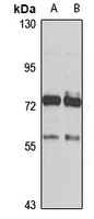 ALKBH8 Antibody