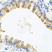 Anti-ALKBH8 Antibody